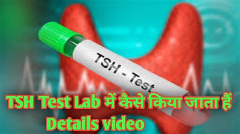 elisa test kaise kiya jata hai|ana elisa test.